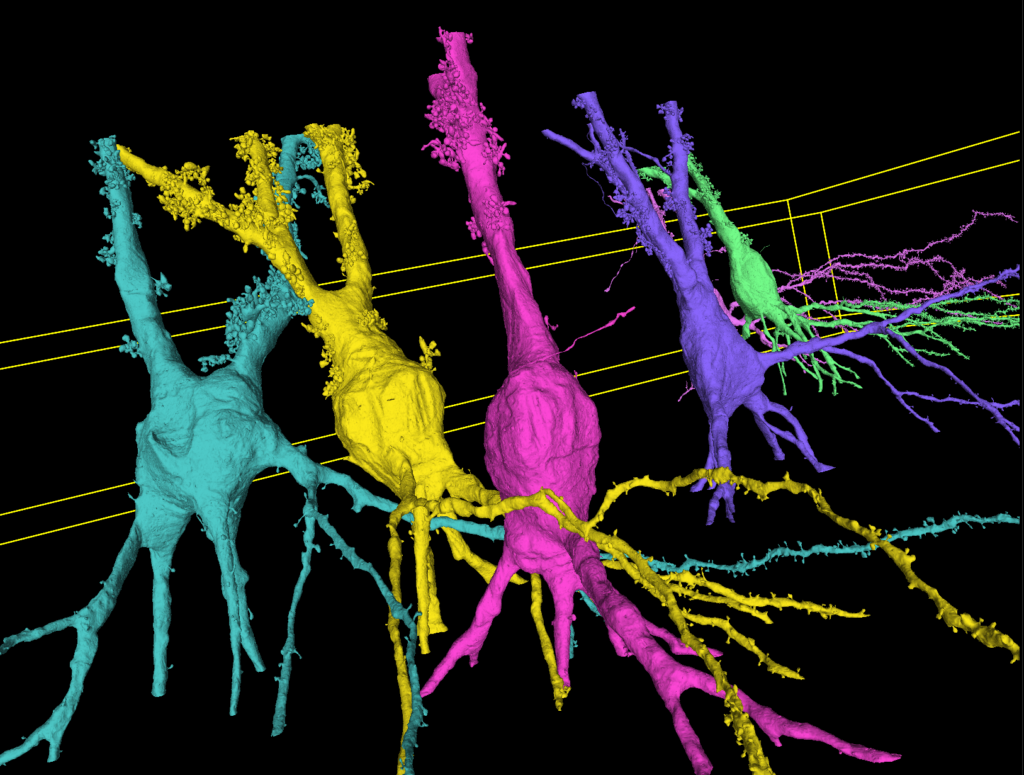 thorny pyramidal neurons